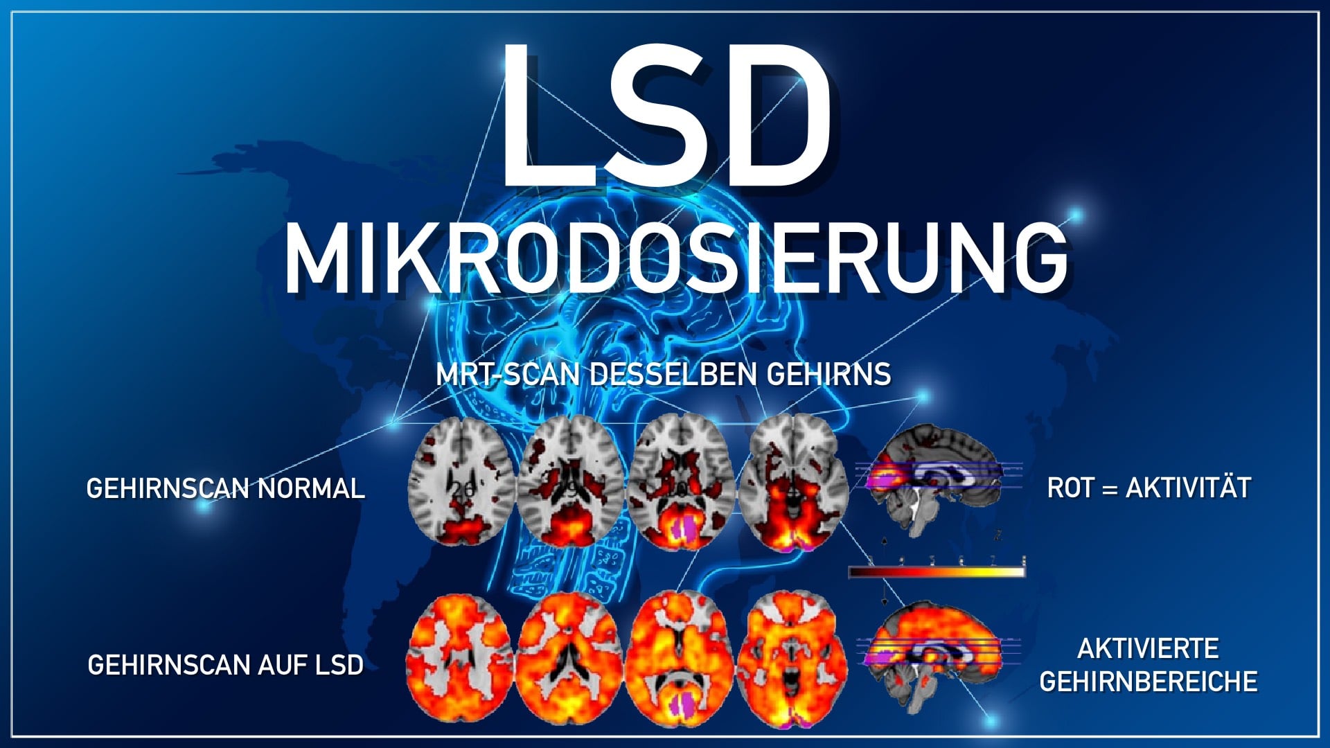 Gehirnscan LSD Mikrodosierung